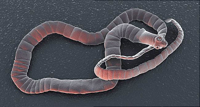 Man Hospitalized With Seizures Discovers Tapeworm Was in Brain for Decades